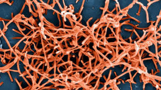 A Shocking Number of People With Ebola Don’t Show Symptoms